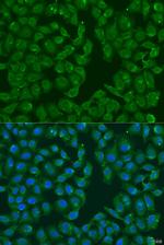 MSRB3 Polyclonal Antibody