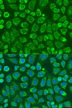 SNX32 Polyclonal Antibody