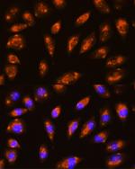 GRID1 Antibody in Immunocytochemistry (ICC/IF)