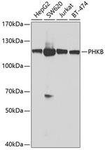 PHKB Polyclonal Antibody