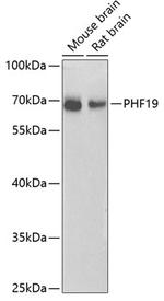PHF19 Antibody in Western Blot (WB)