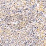 ANAPC2 Polyclonal Antibody