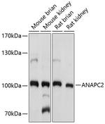 ANAPC2 Antibody in Western Blot (WB)