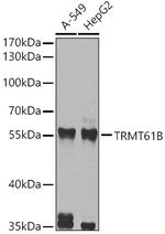 TRMT61B Polyclonal Antibody