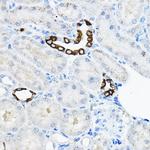 TMEM166 Polyclonal Antibody