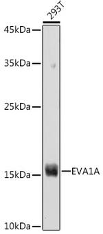 TMEM166 Antibody in Western Blot (WB)