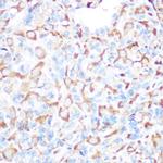 PRAMEF20 Antibody in Immunohistochemistry (Paraffin) (IHC (P))
