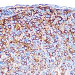 PRAMEF20 Polyclonal Antibody