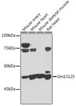 PRAMEF20 Antibody in Western Blot (WB)