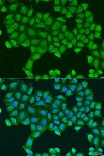 ATP Synthase O Polyclonal Antibody