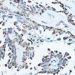 ATP Synthase O Antibody in Immunohistochemistry (Paraffin) (IHC (P))