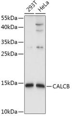 CALCB Polyclonal Antibody