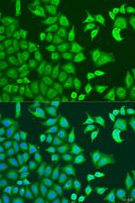 CAPZB Polyclonal Antibody