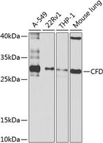 Complement Factor D Polyclonal Antibody