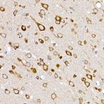 GLUT3 Antibody in Immunohistochemistry (Paraffin) (IHC (P))