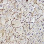 TRPC6 Polyclonal Antibody