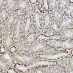 TRPC6 Antibody in Immunohistochemistry (Paraffin) (IHC (P))
