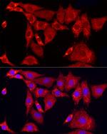 SLC25A11 Polyclonal Antibody