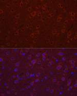 SYT11 Polyclonal Antibody