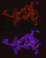 SYT11 Antibody in Immunocytochemistry (ICC/IF)