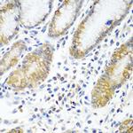 ATAD3A Polyclonal Antibody