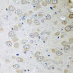 ATAD3A Antibody in Immunohistochemistry (Paraffin) (IHC (P))