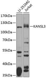 KIAA1310 Polyclonal Antibody