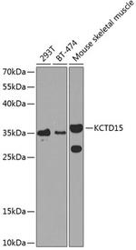 KCTD15 Polyclonal Antibody