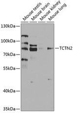TCTN2 Polyclonal Antibody