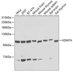 JHDM1D Antibody in Western Blot (WB)