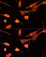 BFAR Polyclonal Antibody