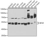 BFAR Antibody in Western Blot (WB)
