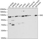 SIK2 Polyclonal Antibody