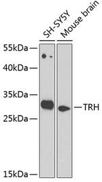 TRH Polyclonal Antibody
