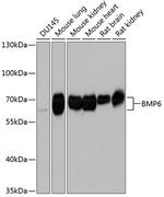 BMP6 Polyclonal Antibody