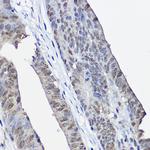 XPC Polyclonal Antibody