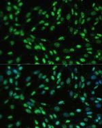 UAP56 Polyclonal Antibody