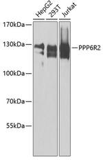 SAPS2 Polyclonal Antibody