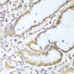 NUDT15 Polyclonal Antibody