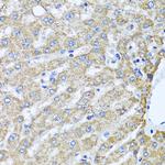 TMEM189 Antibody in Immunohistochemistry (Paraffin) (IHC (P))