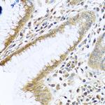 TMEM189 Antibody in Immunohistochemistry (Paraffin) (IHC (P))
