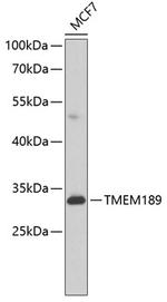 TMEM189 Antibody in Western Blot (WB)