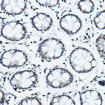 NCoR2 Antibody in Immunohistochemistry (Paraffin) (IHC (P))