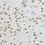 NCoR2 Antibody in Immunohistochemistry (Paraffin) (IHC (P))
