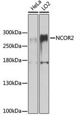 NCoR2 Antibody in Western Blot (WB)
