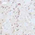 YTHDF3 Antibody in Immunohistochemistry (Paraffin) (IHC (P))