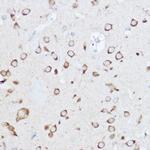 YTHDF3 Antibody in Immunohistochemistry (Paraffin) (IHC (P))