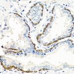 BMP5 Polyclonal Antibody