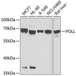 POLL Polyclonal Antibody