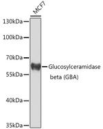 GBA Polyclonal Antibody